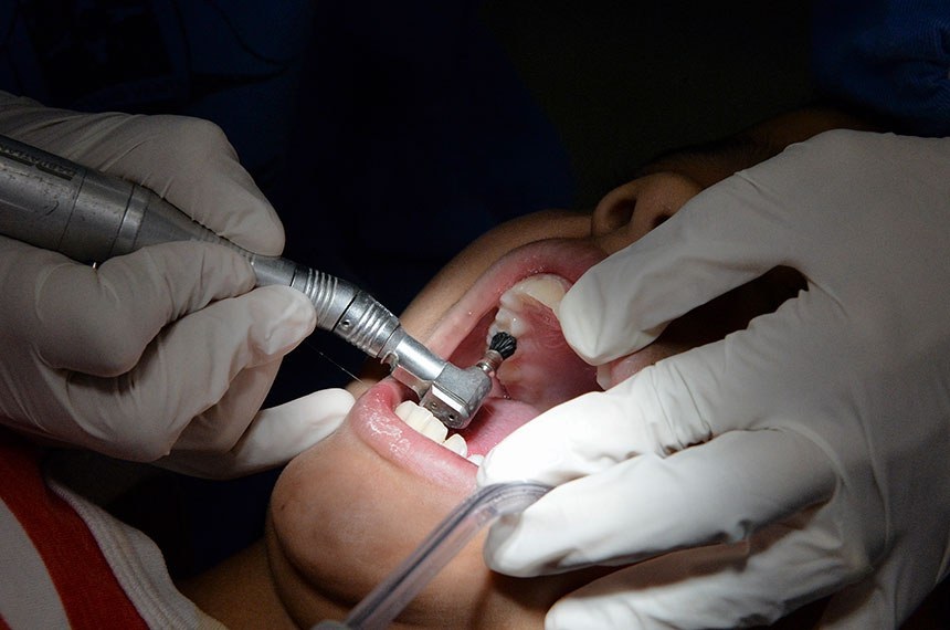 Paciente processa dentista por realizar 32 procedimentos em sessão única