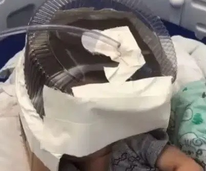 Embalagem de bolo usada em bebê salvou sua vida, diz médica de Santa Cruz, mediante urgência