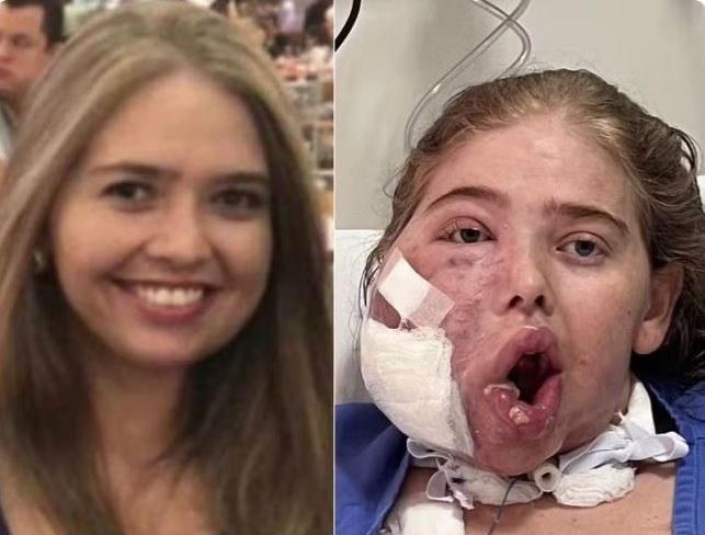 Morre potiguar que lutava contra tumor gigante no rosto