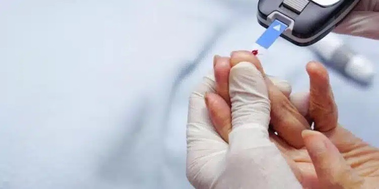 Conheça os 6 alimentos que auxiliam na redução do açúcar no sangue; veja lista