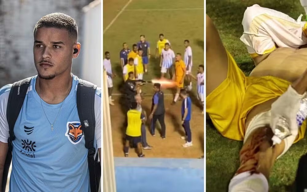 Goleiro baleado por policial ficará até quatro meses sem jogar, diz médico