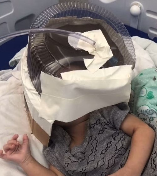 Morre bebê que precisou de máscara de oxigênio improvisada com embalagem de bolo no RN