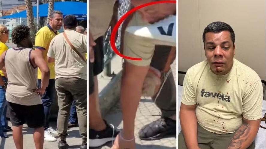 Candidato a vereador é internado após agressão durante campanha 
