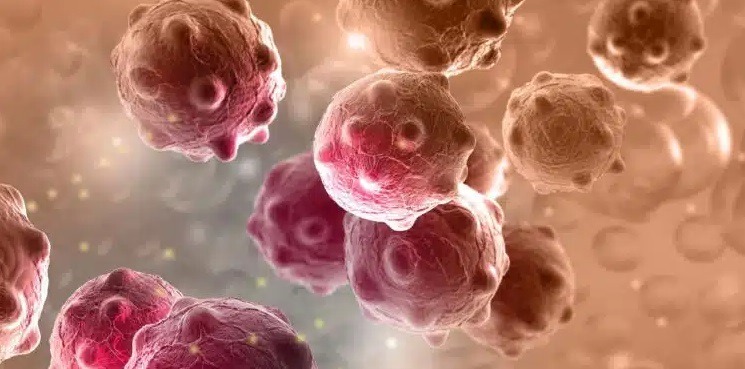 Alerta: conheça três tipos de cânceres silenciosos que você pode estar ignorando; veja sinais