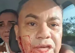 “Vão me matar e as autoridades não fazem nada”, desabafa empresário que sofreu atentado na Grande Natal