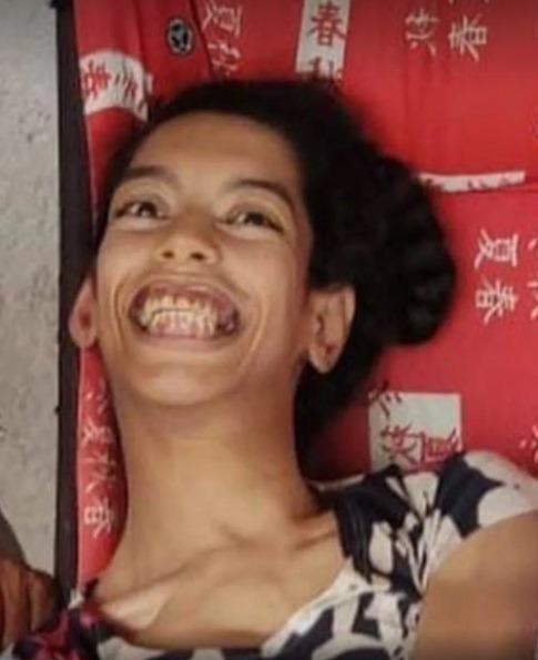 Mulher com deficiência física morre durante incêndio dentro de casa no RN