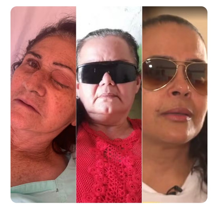 ‘Fui na esperança de enxergar’: veja relatos de pacientes infectados em mutirão de cataratas no RN