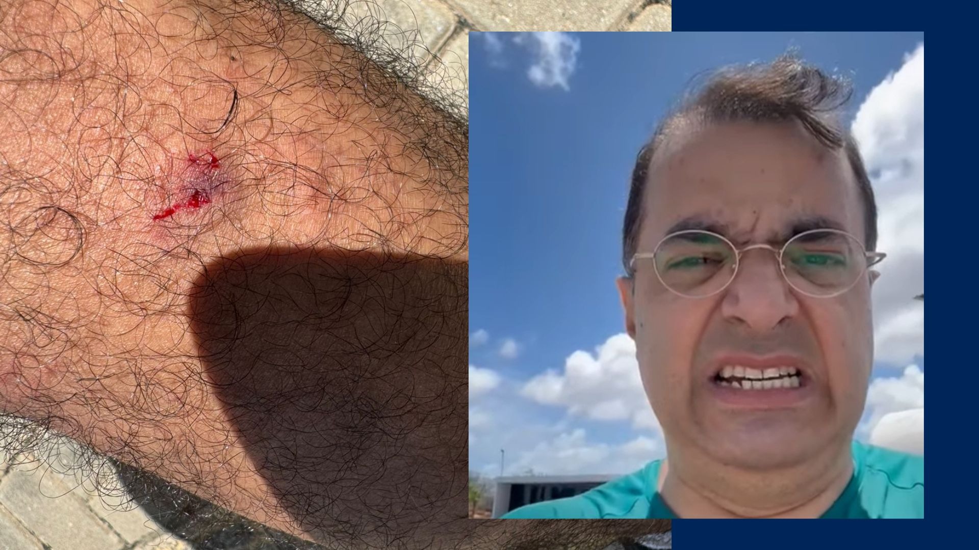 VÍDEO: Advogado é atacado por "cães raivosos" no Parque da Cidade