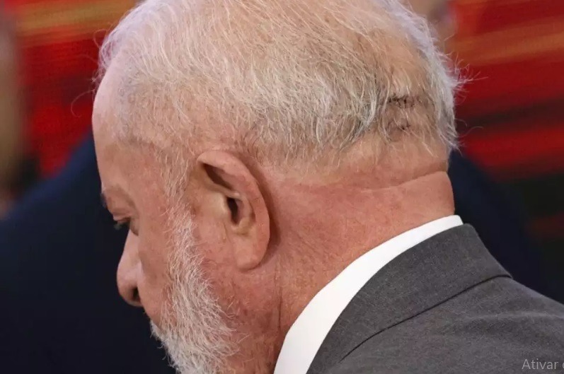Após cirurgia, Lula conversa, se alimenta normalmente e não terá sequelas, dizem médicos