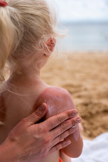 A chegada do verão e a importância dos cuidados com a pele 