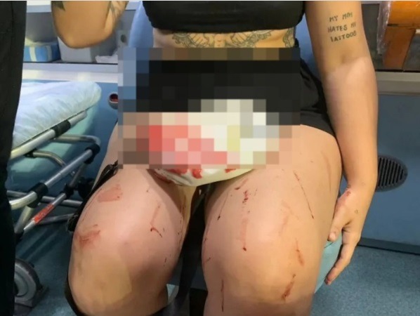 Mulher nega compartilhar equipamento de academia e acaba ferida na cabeça em Natal