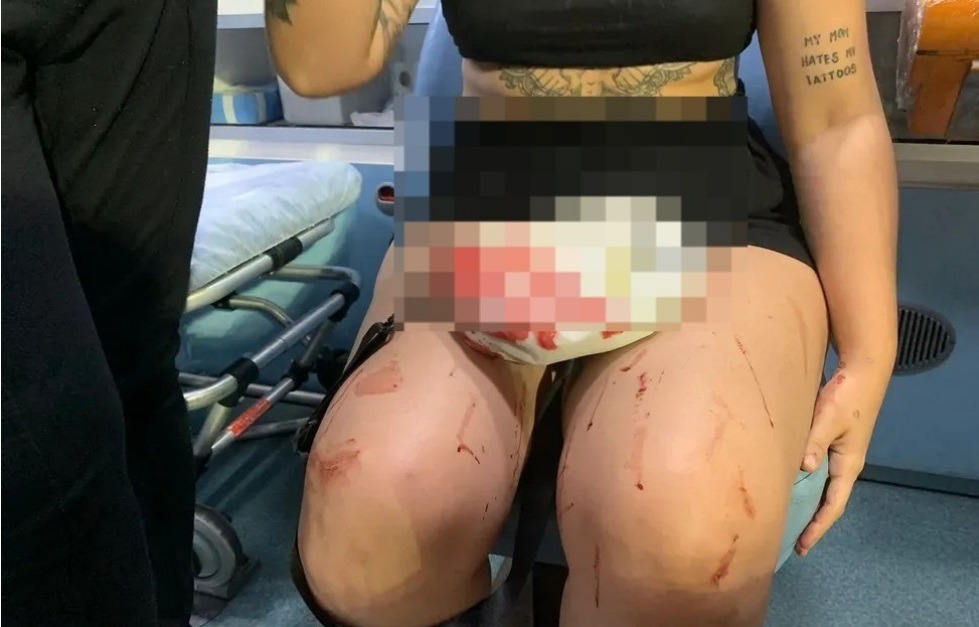 Mulher que agrediu outra na academia em Natal foi presa e responderá por lesão corporal grave