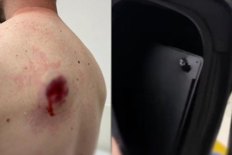 Notebook salva vida de homem baleado nas costas em São Paulo