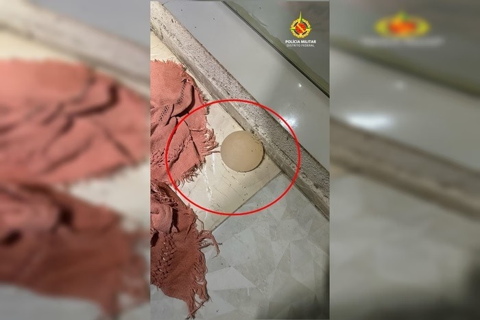 Mulher tem silicone tirado à força com faca de cozinha após briga com marido