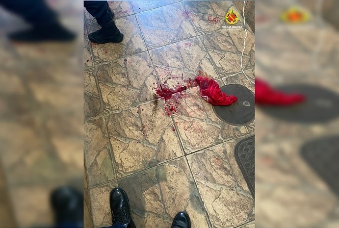 Homem esfaqueia vizinho após cueca sumir de varal