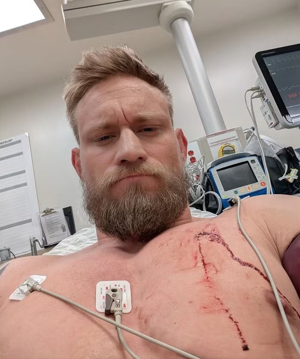 Ex-UFC é esfaqueado ao sair para jogar o lixo, reage e nocauteia agressor