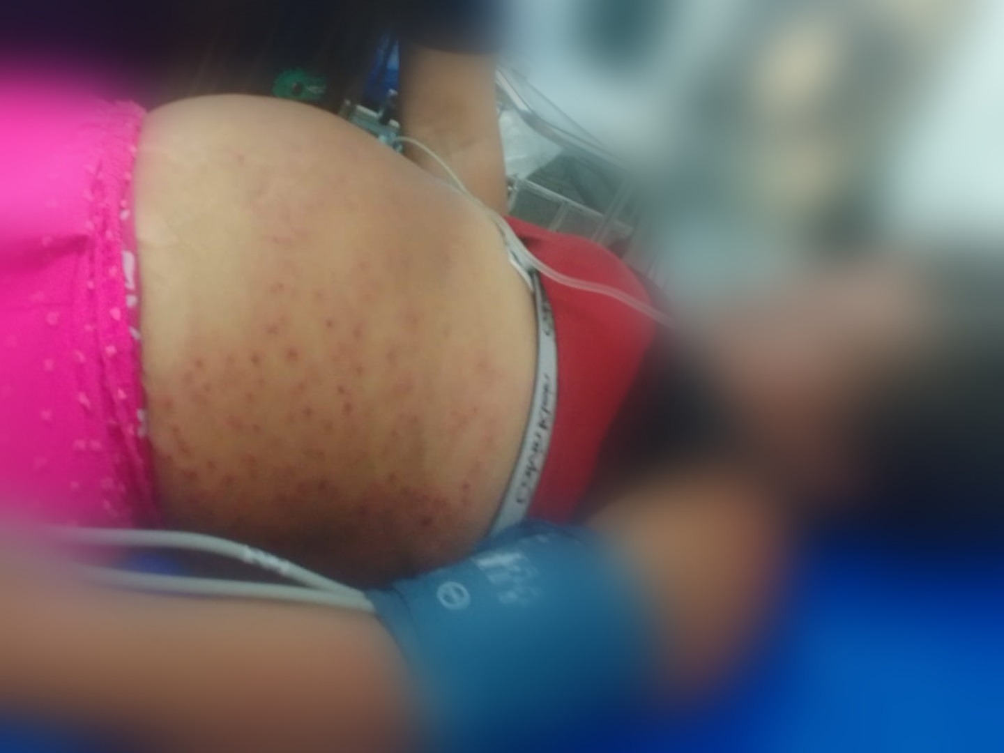 Mulher fica em estado grave após ser atacada por abelhas na Grande Natal