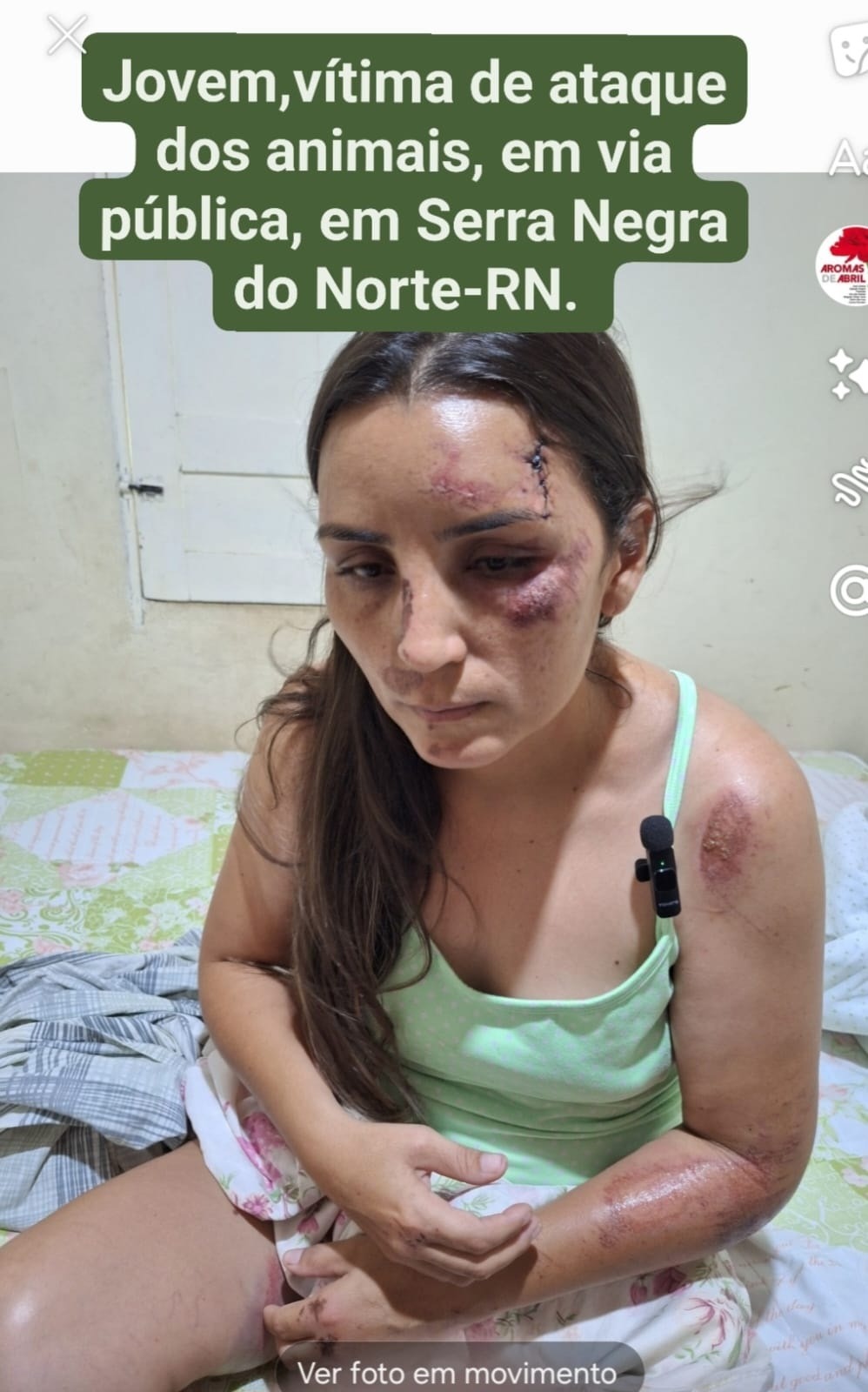 Mulher é atacada por cães de rua no interior do RN