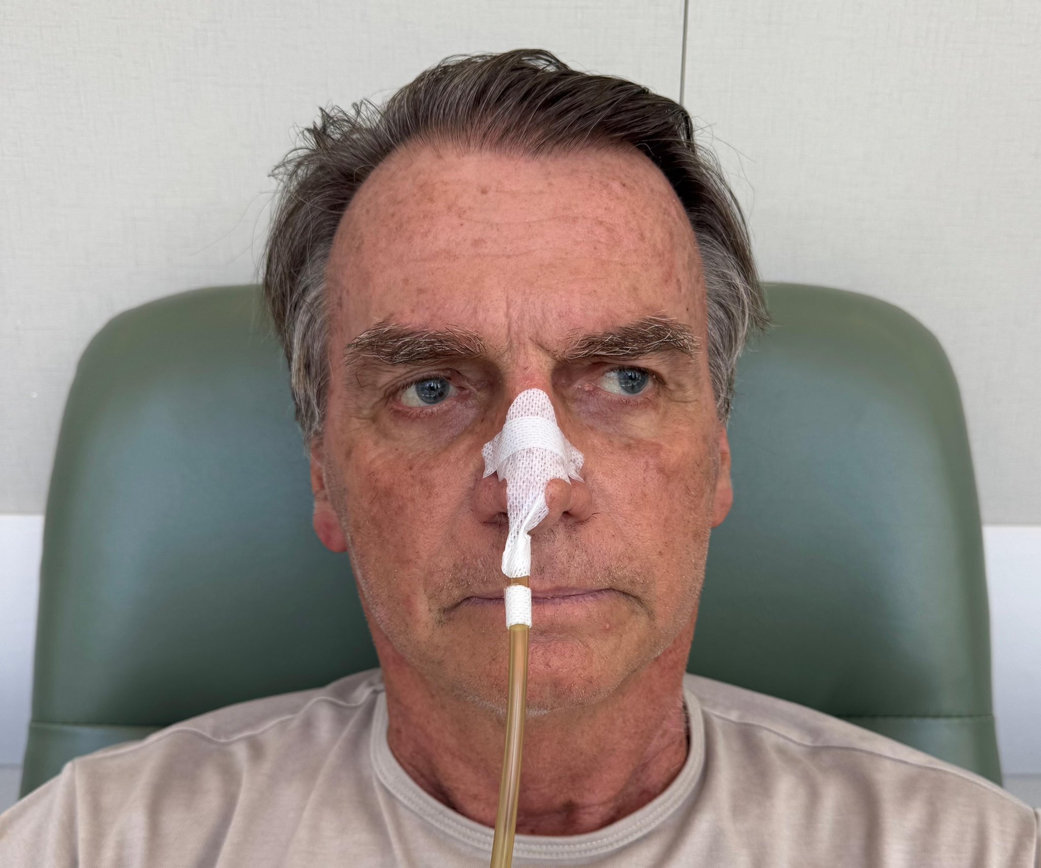 Bolsonaro passa por tratamento para controle de alterações no fígado