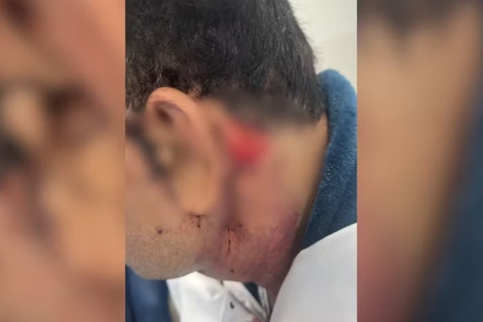 Homem denuncia negligência médica após ter lesões em cirurgia plástica