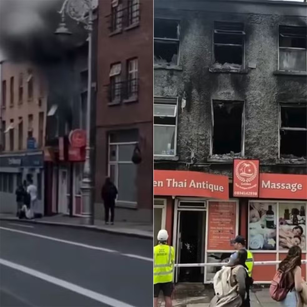 Potiguar fica em estado grave após incêndio em prédio na Irlanda