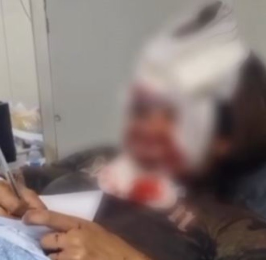 Sem conseguir falar, mulher espancada por namorado em Natal escreve depoimento