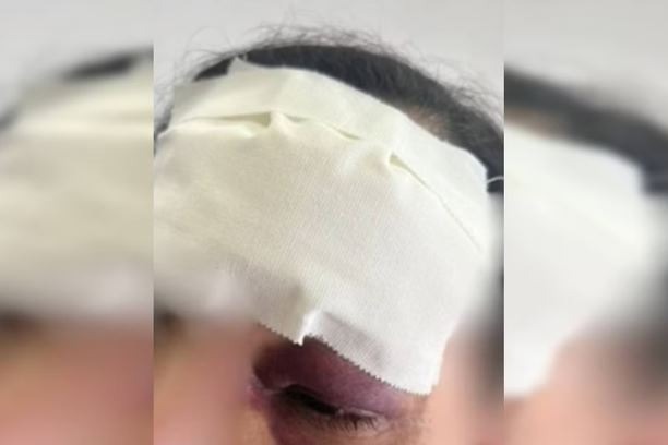 Mais um valentão: Homem ataca companheira com socos e arremessa celular no rosto dela
