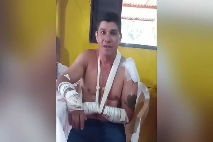 Motociclista que sobreviveu a ataque de onça conta experiência