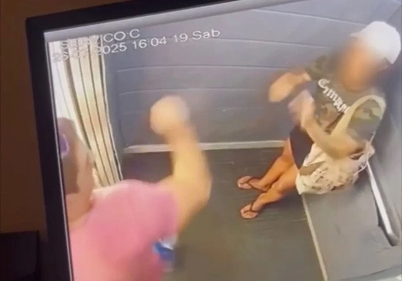 Vítima de agressão em elevador recebe alta hospitalar após cirurgia facial