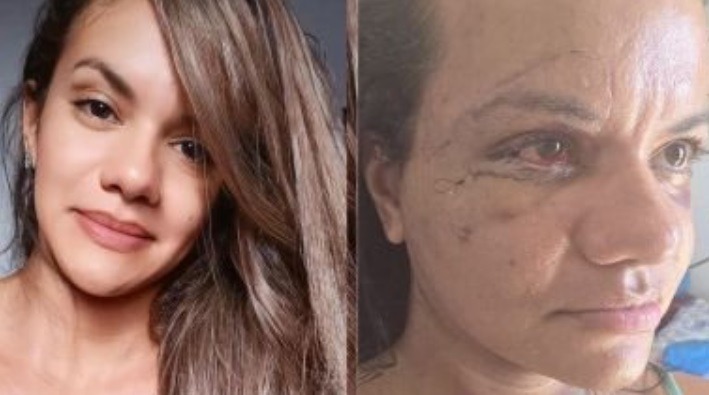 Mãe de Juliana fala sobre agressão brutal que chocou o país. “Eu nunca gostei dele”