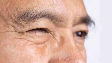 Tremor nas pálpebras: o que isso significa? É preciso se preocupar?  