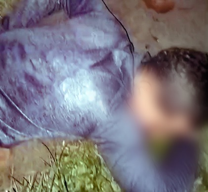 Tentativa de chacina deixa um morto e três feridos em zona rural do RN