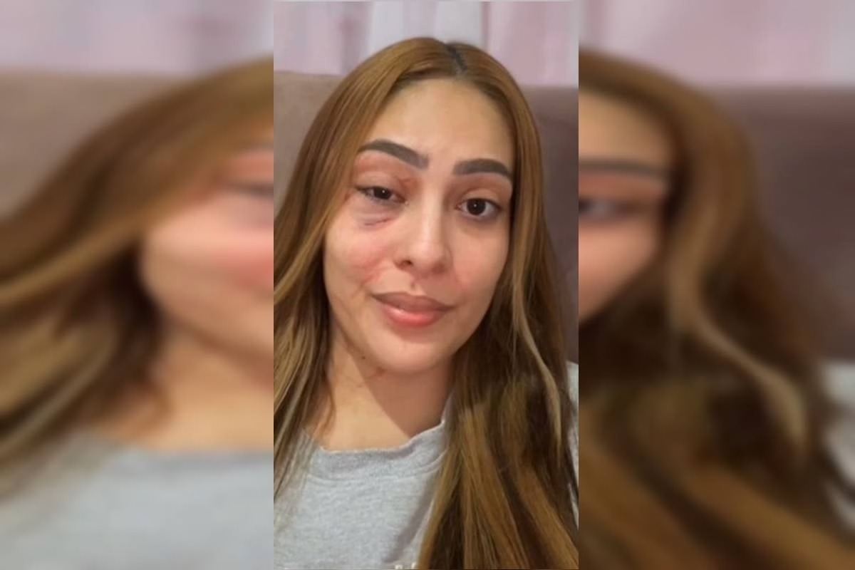 Jovem é atacada por vizinho de cueca dentro de casa e ainda ouve ofensas da esposa dele