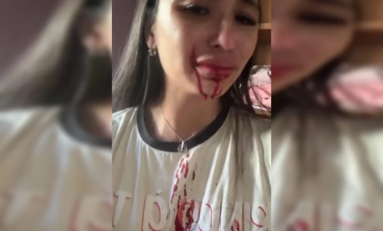 Ex-bailarina do Faustão recebe medida protetiva após ataque com faca da mãe