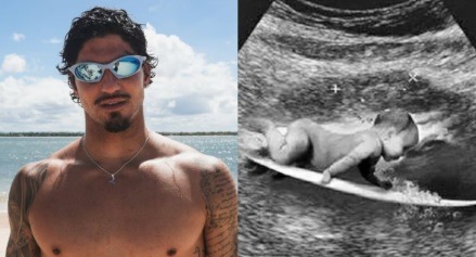Gabriel Medina posta ultrassom e engana fãs com suposta gravidez; tudo não passava de jogada de marketing
