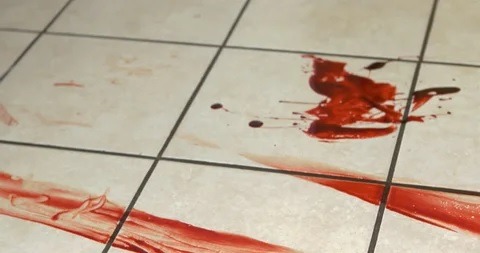 Homem decepa dedo e orelha de mulher em tentativa de feminicídio na Grande Natal