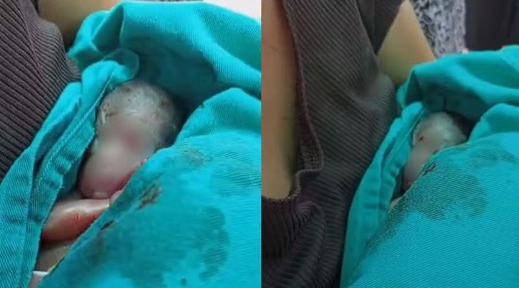 Bebê prematuro dado como morto é retirado do próprio velório com vida após família ouvir choro