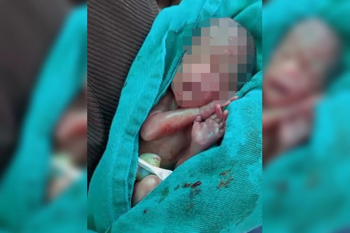 Morre bebê que chorou no próprio velório e foi retirado de caixão