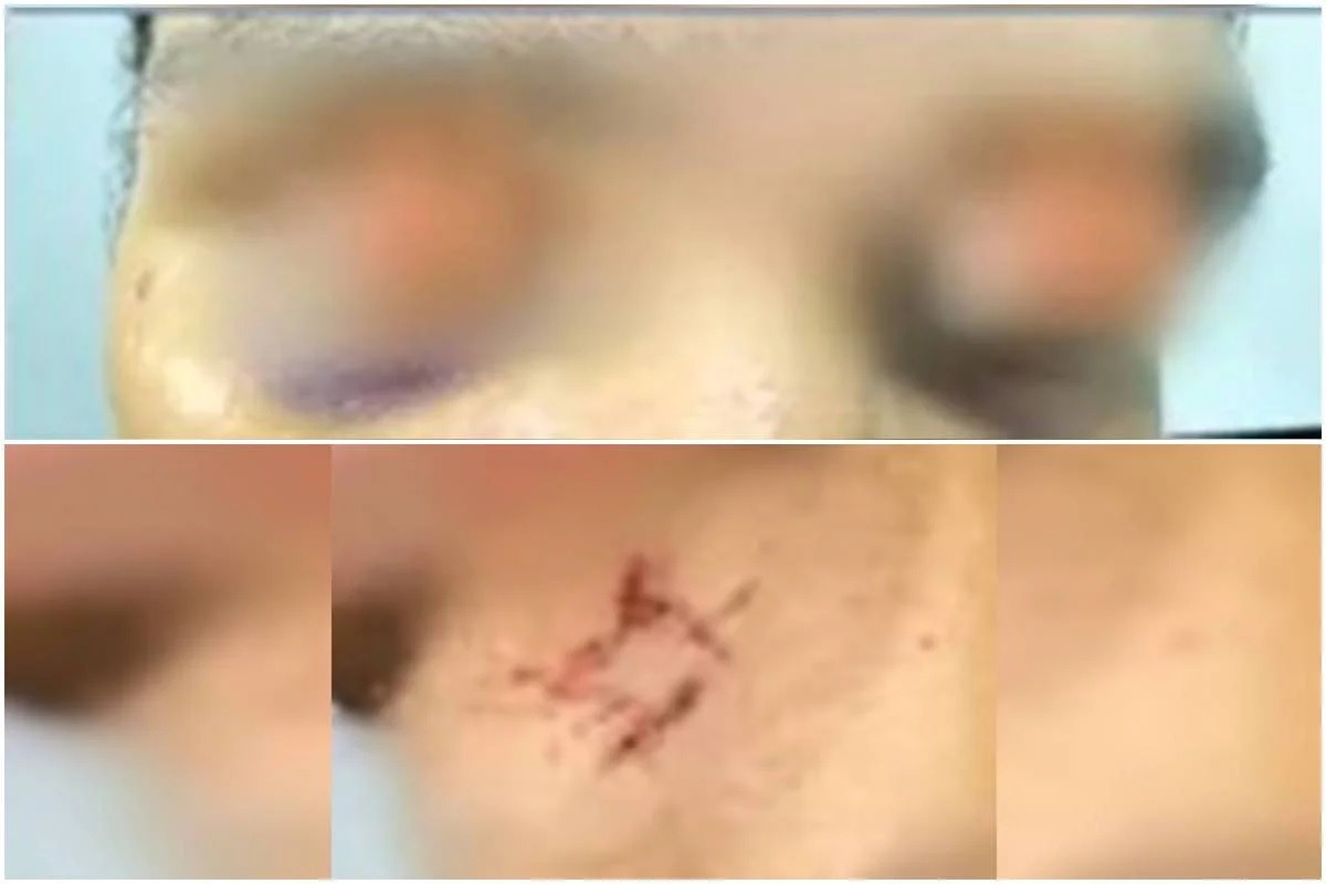 “Sexo por drogas”: criminoso diz que prendeu vítima após se apaixonar
