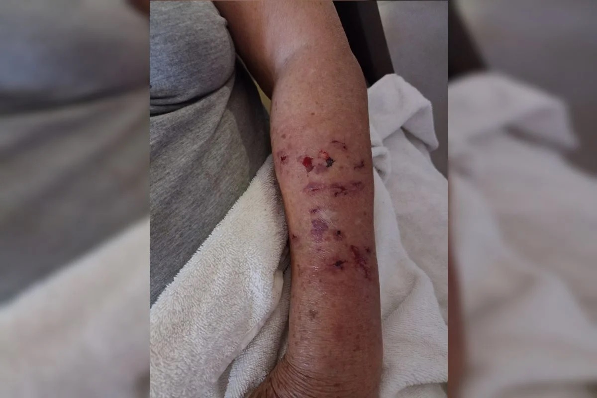 Garrafada e chute na cabeça: como idosa se livrou de ataque de cães