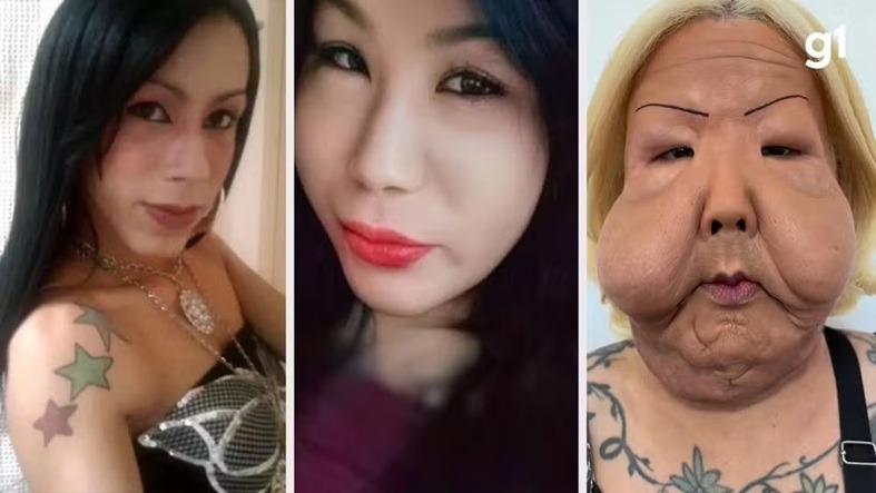 Quem é 'Juju do Pix', influencer que fez cirurgia para tirar óleo do rosto