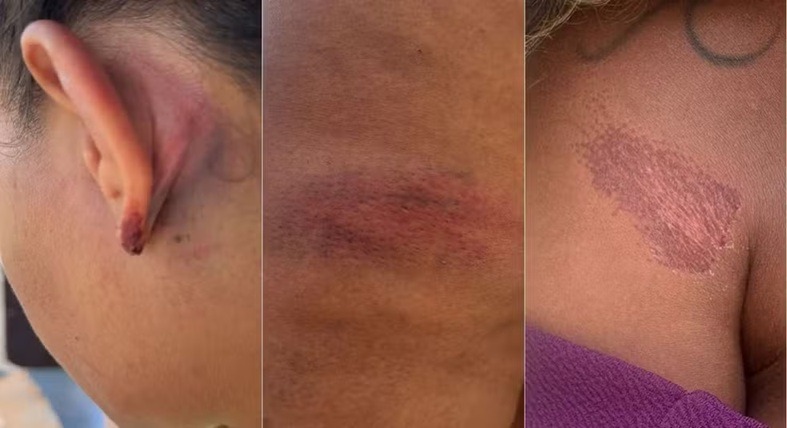 Policiais militares são afastados após denúncia de agressões contra advogada no interior do RN