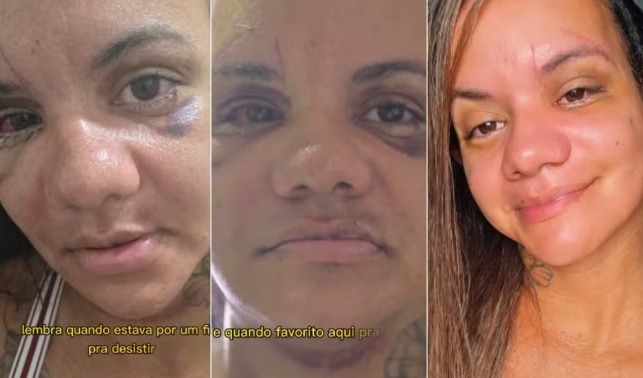 Câmara de Natal mantém veto a projeto sobre câmeras após caso de agressão de 61 socos em elevador