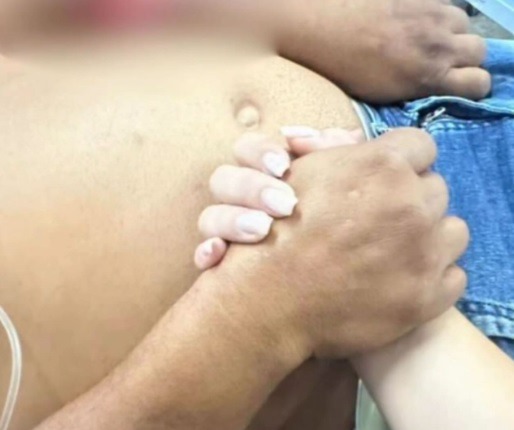 Homem é atacado pelo próprio pitbull no interior do RN e sofre corte profundo no antebraço