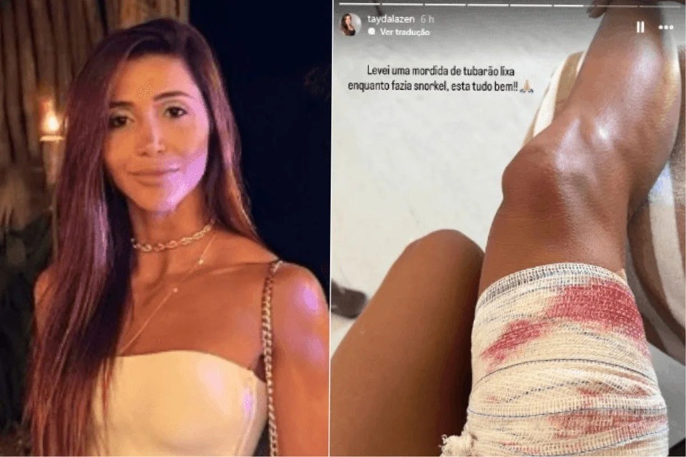 Mulher é mordida por tubarão em Fernando de Noronha