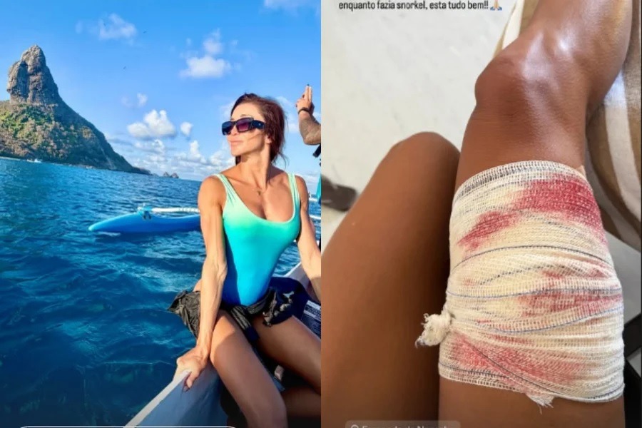 [VÍDEO] Noronha: veja exato momento em que surfista é mordida por tubarão