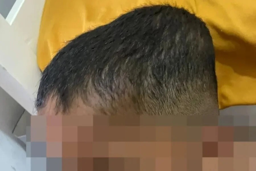 Babá é acusada de tortura menino autista de 5 anos