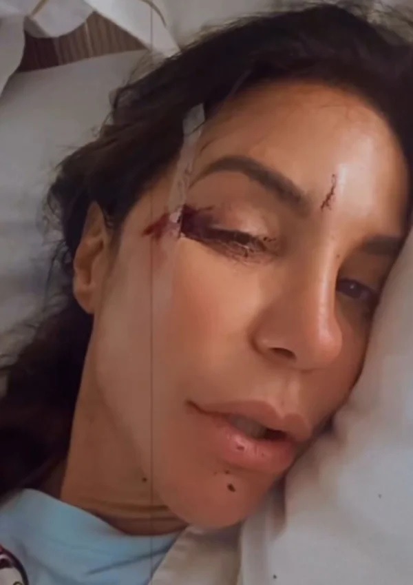 [VÍDEO] Ivete Sangalo passa mal, desmaia e sofre queda em casa; saiba detalhes