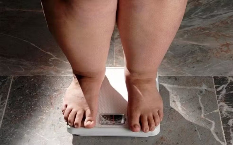 RN é o 2º estado do país com mais adultos obesos, diz Ministério da Saúde
