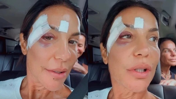 Ivete Sangalo passará por cirurgia após internação